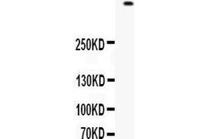 Western blot analysis of Filaggrin expression in 22RV1 whole cell lysates (lane 1). (Filaggrin 抗体  (AA 1-261))