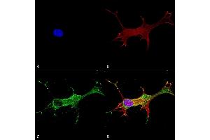 Immunocytochemistry/Immunofluorescence analysis using Mouse Anti-Notch1 Monoclonal Antibody, Clone S253-32 (ABIN2483203). (Notch1 抗体  (AA 20-216) (PerCP))