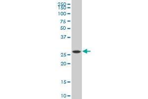 PNPO polyclonal antibody (A01), Lot # 060529JCS1 Western Blot analysis of PNPO expression in MES-SA/Dx5 . (PNPO 抗体  (AA 163-261))