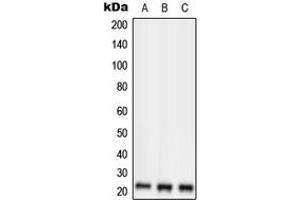 Western blot analysis of RKIP expression in HepG2 (A), SP2/0 (B), H9C2 (C) whole cell lysates. (PEBP1 抗体  (Center))