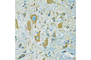 Immunohistochemistry (Paraffin-embedded Sections) (IHC (p)) image for anti-Ribosomal Protein S7 (RPS7) (AA 1-194) antibody (ABIN6147244)