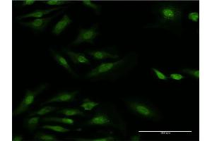 Immunofluorescence of monoclonal antibody to RPS29 on HeLa cell. (RPS29 抗体  (AA 1-56))