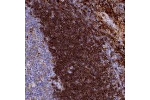 Immunohistochemical staining of human tonsil with PLAC8 polyclonal antibody  shows strong cytoplasmic positivity in lymphoid cells outside reaction centra. (PLAC8 抗体)