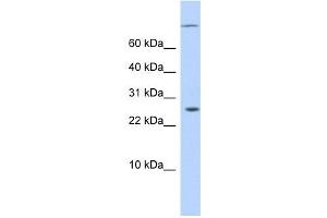ARID5A antibody used at 0. (ARID5A 抗体  (N-Term))