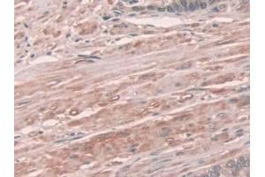 Immunohistochemistry (IHC) image for anti-NADPH Oxidase 1 (NOX1) (AA 235-488) antibody (ABIN7439315)