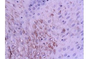 Immunohistochemistry (IHC) image for anti-Zinc Finger, Matrin-Type 3 (ZMAT3) (AA 70-120) antibody (ABIN722781)