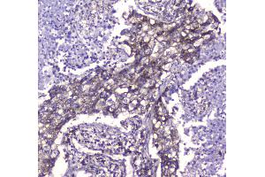 Immunohistochemistry (IHC) image for anti-ClpP Caseinolytic Peptidase, ATP-Dependent, Proteolytic Subunit Homolog (E. Coli) (CLPP) (AA 184-247) antibody (ABIN5693176)