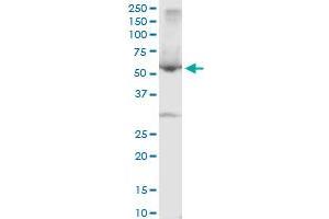 Western Blotting (WB) image for anti-serpin Peptidase Inhibitor, Clade A (Alpha-1 Antiproteinase, Antitrypsin), Member 10 (SERPINA10) (AA 22-444) antibody (ABIN565547)