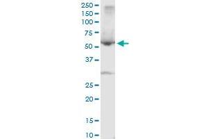 SERPINA10 polyclonal antibody (A01), Lot # UAU2060323QCS1. (SERPINA10 抗体  (AA 22-444))