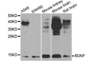 Western blot analysis of extracts of various cell lines, using BDNF antibody. (BDNF 抗体  (AA 20-247))