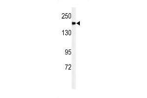 Western blot analysis of A2ML1 Antibody (N-term) (ABIN650922 and ABIN2839996) in mouse lung tissue lysates (35 μg/lane). (A2ML1 抗体  (N-Term))