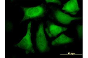 Immunofluorescence of purified MaxPab antibody to CACYBP on HeLa cell. (CACYBP 抗体  (AA 1-228))