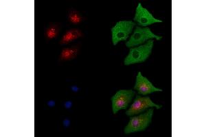 ABIN6264613 and ABIN6277733 staining  cells by IF/ICC. (RAD21 抗体  (C-Term))