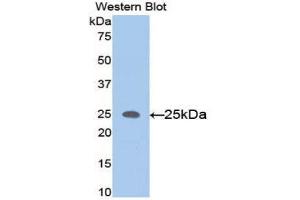 Western Blotting (WB) image for anti-Matrix Metallopeptidase 11 (Stromelysin 3) (MMP11) (AA 287-491) antibody (ABIN1078305)