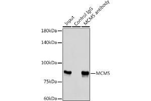 Immunoprecipitation analysis of 300 μg extracts of HeLa cells using 3 μg MCM5 antibody (ABIN6132075, ABIN6143645, ABIN6143647 and ABIN6221204). (MCM5 抗体  (AA 1-230))
