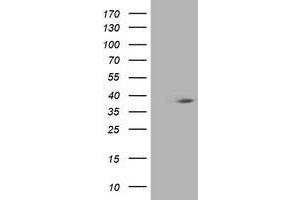 Western Blotting (WB) image for anti-HSPA Binding Protein, Cytoplasmic Cochaperone 1 (HSPBP1) antibody (ABIN1498761) (HSPBP1 抗体)