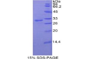 SDS-PAGE analysis of Rat PNMA2 Protein.