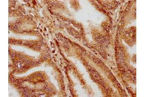 IHC image of ABIN7155766 diluted at 1:400 and staining in paraffin-embedded human prostate tissue performed on a Leica BondTM system. (Homeobox D13 抗体  (AA 151-254))