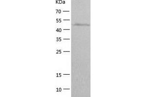 Western Blotting (WB) image for Cyclin B1 (CCNB1) (AA 1-433) protein (His tag) (ABIN7122521) (Cyclin B1 Protein (CCNB1) (AA 1-433) (His tag))
