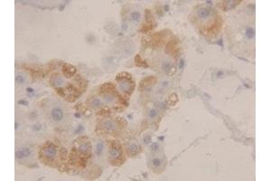 Detection of HEXb in Human Liver Tissue using Polyclonal Antibody to Hexosaminidase B Beta (HEXb) (HEXB 抗体  (AA 315-456))