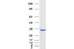 Western Blotting (WB) image for Uridine-Cytidine Kinase 1 (UCK1) (Transcript Variant 1) protein (Myc-DYKDDDDK Tag) (ABIN2734966)