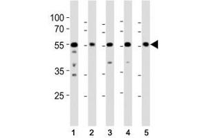 Western Blotting (WB) image for anti-Proto-oncogene tyrosine-protein kinase Src (Src) (AA 24-52) antibody (ABIN3029552)