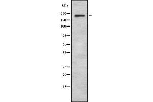 Western Blotting (WB) image for anti-Sodium Channel, Voltage-Gated, Type VIII, alpha (SCN8A) (Internal Region) antibody (ABIN6263505)