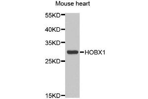 Western blot analysis of extracts of Mouse heart cell line, using HOXB1 antibody. (HOXB1 抗体)