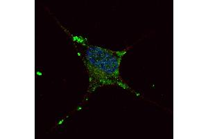 Fluorescent confocal image of SY5Y cells stained with ELP2 antibody. (ELP2 抗体  (C-Term))