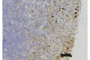 Immunohistochemistry (IHC) image for anti-Collagen, Type XVII, alpha 1 (COL17A1) (N-Term) antibody (ABIN6260957)