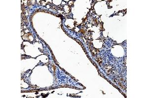 IHC analysis of Liver Carboxylesterase 1/CES1 using anti-Liver Carboxylesterase 1/CES1 antibody (ABIN7602719).