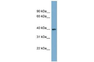 ASPHD2 antibody used at 1 ug/ml to detect target protein. (ASPHD2 抗体  (Middle Region))