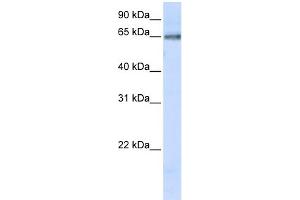 WB Suggested Anti-DCLRE1C Antibody Titration:  0. (DCLRE1C 抗体  (C-Term))