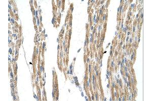 Immunohistochemistry (IHC) image for anti-Alanine Aminotransferase (ALT) (N-Term) antibody (ABIN2782331) (ALT 抗体  (N-Term))