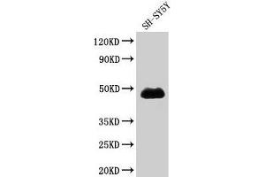 Western Blot Positive WB detected in: SH-SY5Y whole cell lysate All lanes: NADK antibody at 1. (NADK 抗体  (AA 1-300))