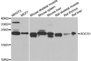 Western blot analysis of extracts of various cell lines, using SOCS1 antibody. (SOCS1 抗体)