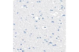 Immunohistochemistry (IHC) image for anti-Catenin (Cadherin-Associated Protein), delta 1 (CTNND1) antibody (ABIN7266144)