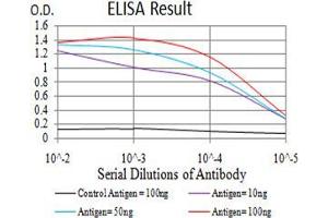 Black line: Control Antigen (100 ng);Purple line: Antigen (10ng); Blue line: Antigen (50 ng); Red line:Antigen (100 ng) (TTF1 抗体  (AA 1-150))