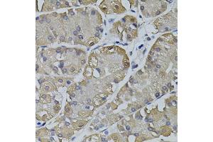 Immunohistochemistry of paraffin-embedded human stomach using TRPC3 antibody (ABIN5995383) (40x lens). (TRPC3 抗体)