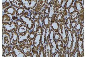ABIN6272406 at 1/100 staining Rat kidney tissue by IHC-P. (RAB34 抗体  (Internal Region))