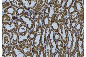 ABIN6272406 at 1/100 staining Rat kidney tissue by IHC-P.