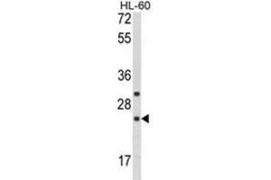 Western blot analysis of RGS1 Antibody (N-term) in HL-60 cell line lysates (35ug/lane). (RGS1 抗体  (N-Term))