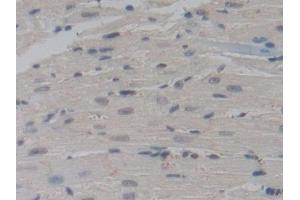 Immunohistochemistry (IHC) image for anti-Nucleoporin 85kDa (NUP85) (AA 418-653) antibody (ABIN7443359)