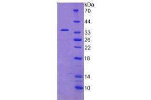 Image no. 1 for Janus Kinase 2 (JAK2) (AA 508-800) (Active) protein (His tag) (ABIN6239839) (JAK2 Protein (AA 508-800) (His tag))