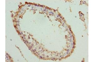 Immunohistochemistry of paraffin-embedded human testis tissue using ABIN7166711 at dilution of 1:100 (MOV1 (AA 601-900) 抗体)