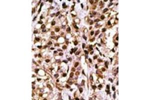 Immunohistochemistry (Paraffin-embedded Sections) (IHC (p)) image for anti-Autophagy related 4A Cysteine Peptidase (ATG4A) (AA 369-398), (C-Term) antibody (ABIN1449633)