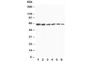 Western blot testing of FMO4 antibody and Lane 1:  rat liver;  2: mouse liver;  3: human SMMC-7721;  4: (m) HEPA;  5: (h) A431;  6: (h) MCF-7 cell lysate. (FMO4 抗体  (N-Term))