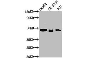 Western Blot Positive WB detected in: HepG2 whole cell lysate, SH-SY5Y whole cell lysate, PC-3 whole cell lysate All lanes: CXorf36 antibody at 3. (CXORF36 抗体  (AA 311-405))