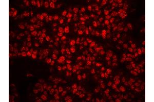 Immunofluorescence (IF) image for anti-Replication Protein A2, 32kDa (RPA2) (pSer4), (pSer8) antibody (ABIN7449013)