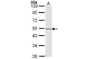 WB Image Sample (30 ug of whole cell lysate) A: 293T 10% SDS PAGE antibody diluted at 1:1000 (RNF13 抗体  (C-Term))